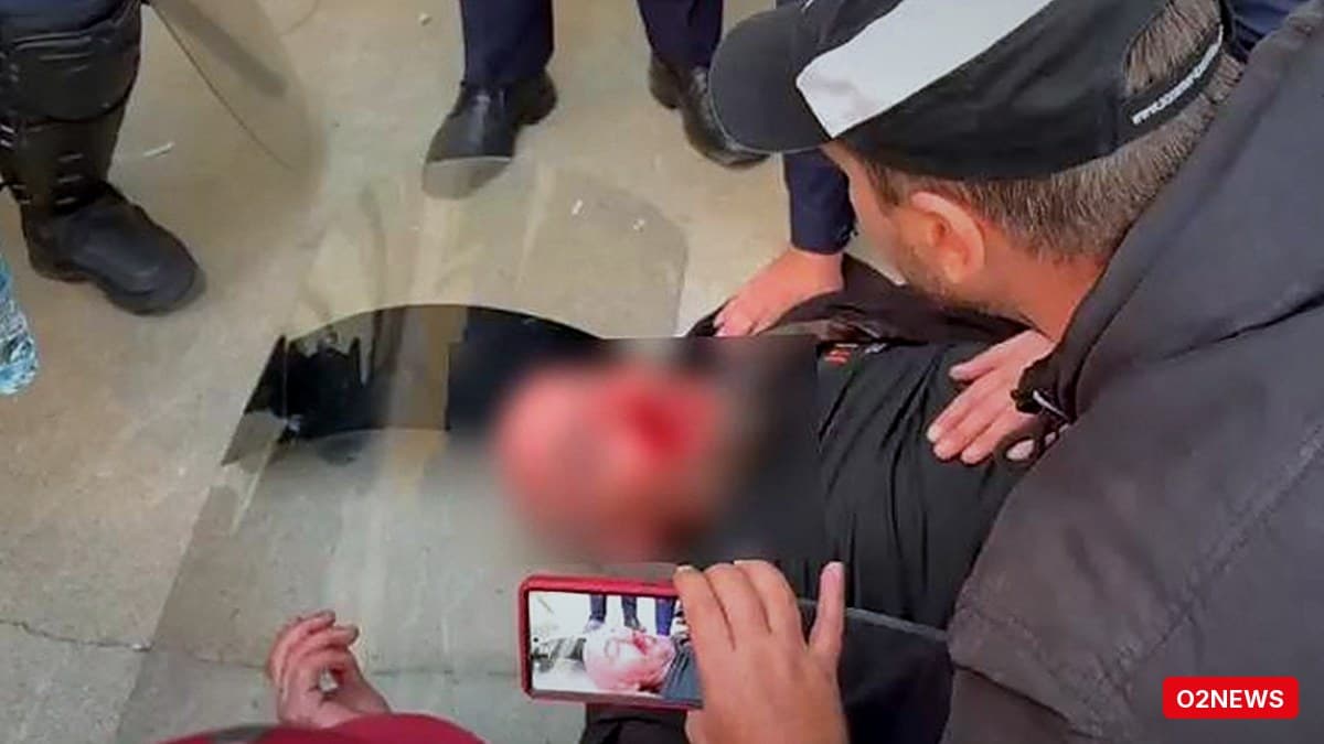 Qytetar i gjakosur dërgohet në spital në Tiranë, pretendon se u godit nga policia dhe s’ishte në protestë